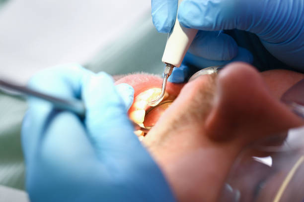 Best Emergency Dental Care for Sports Injuries in Keyport, NJ