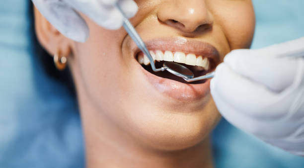 Best Emergency Wisdom Tooth Extraction in Keyport, NJ